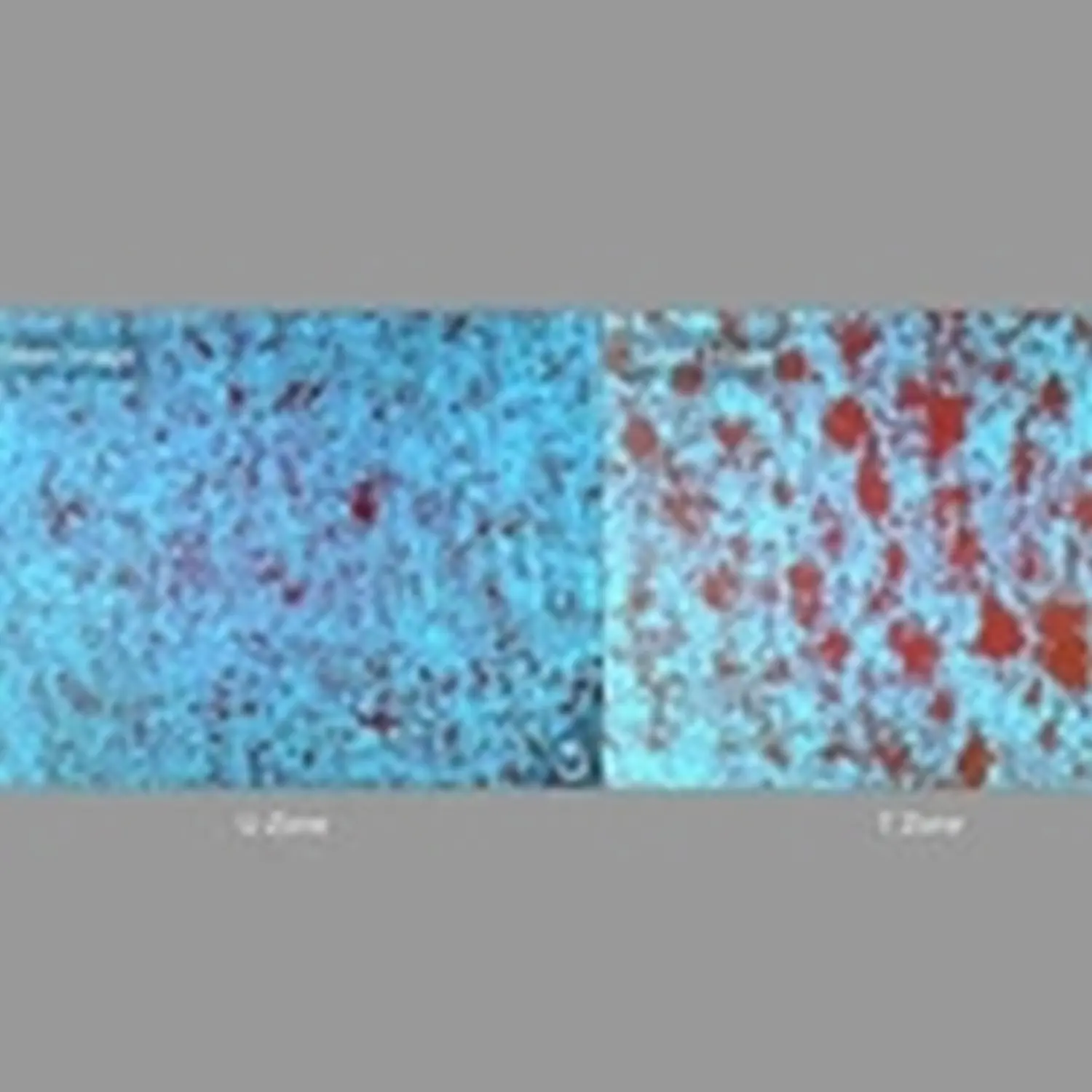 Feine Haut – Kosmetik – Sebum- / Lipidgehalt