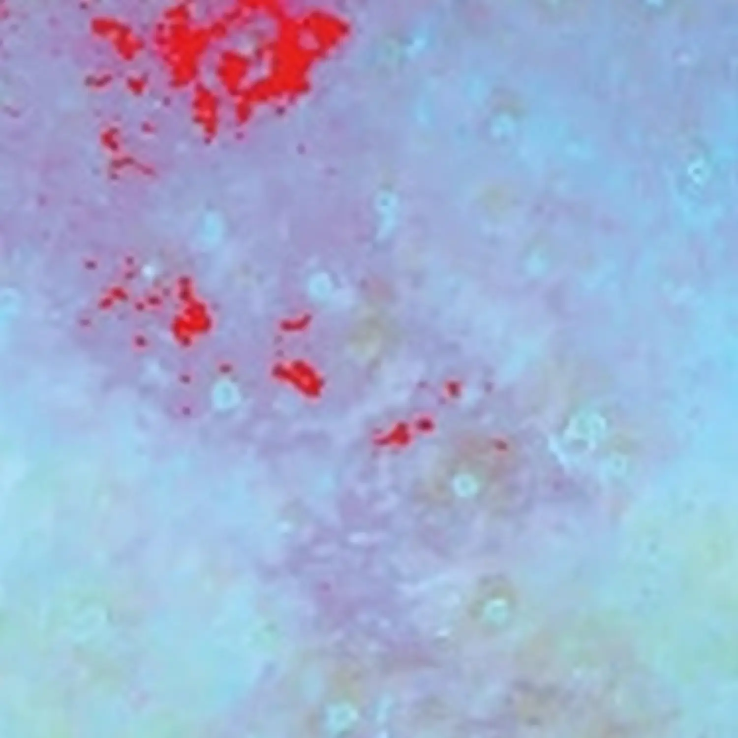 Feine Haut – Kosmetik – Rötungen und Sensibilität