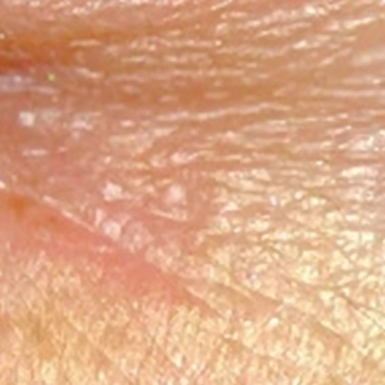 Feine Haut – Kosmetik – Falten & Linien