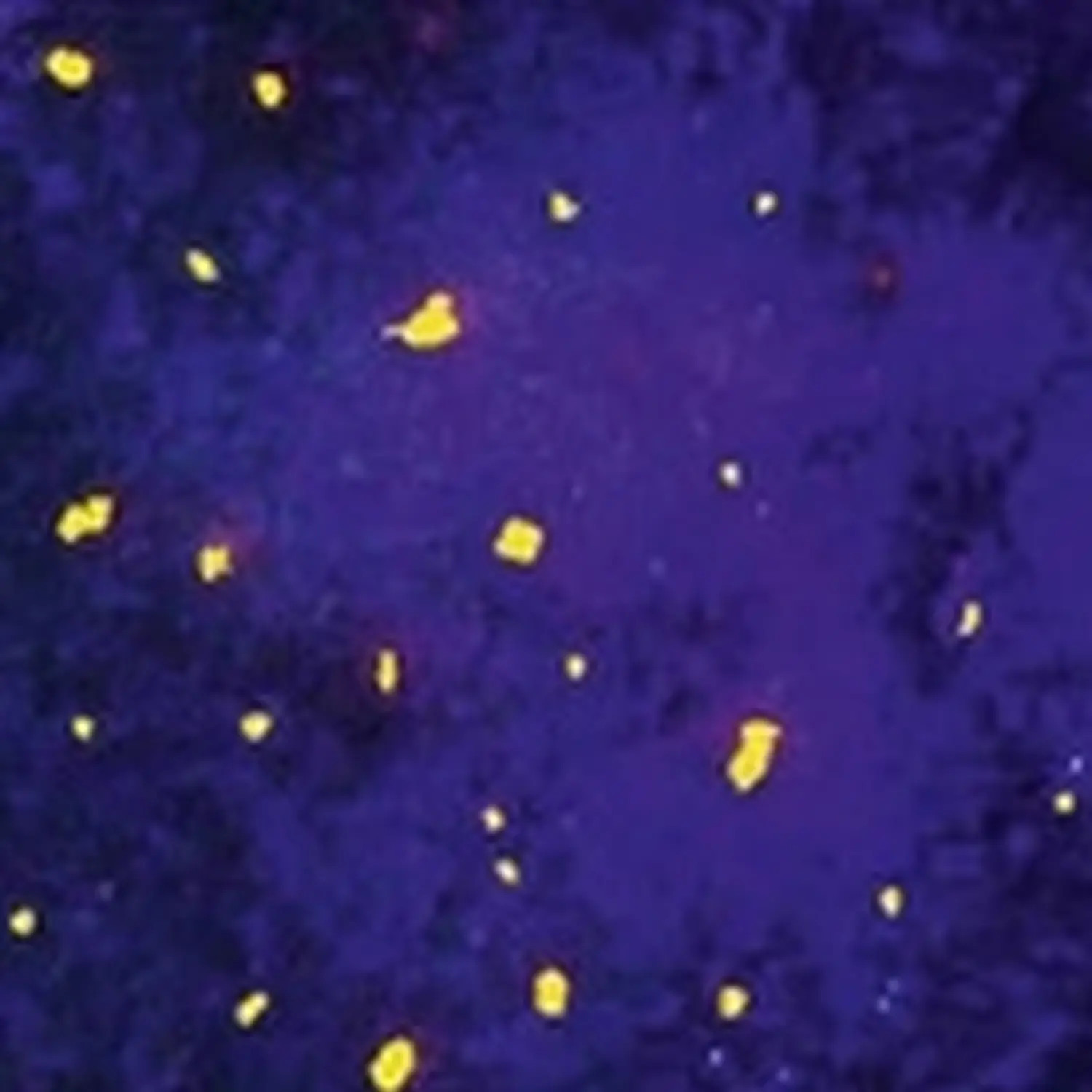 Feine Haut – Kosmetik – Unreinheiten, Pickel & Unterlagerungen