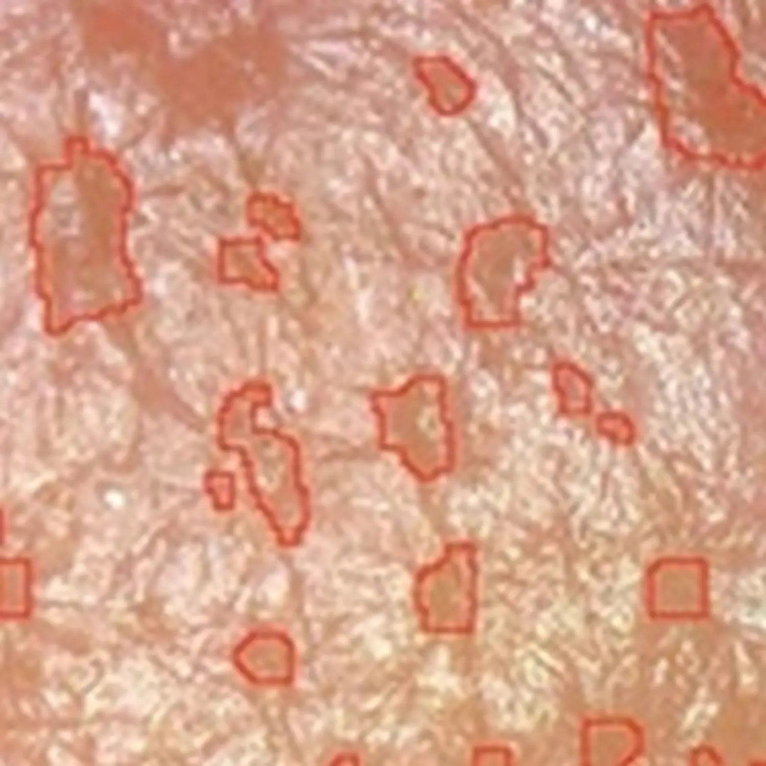 Feine Haut – Kosmetik – Porengröße